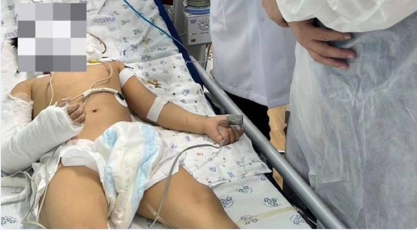 Бишкекте алтынчы кабаттан кулап түшкөн 4 жашар кыз комадан чыкты
&nbsp;